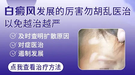 手上有白斑越来越多了