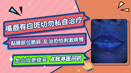 嘴唇有白斑可以照光吗