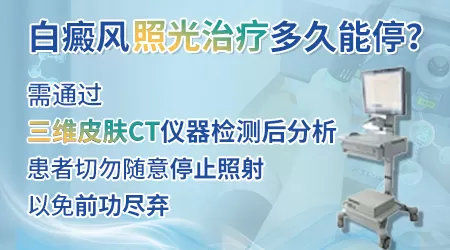 白癜风照紫外线需要注意什么