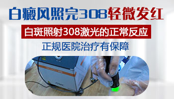 白斑做了308激光后发红是好转吗