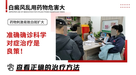 治疗白癜风用生物制剂好还是照308激光好