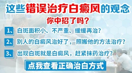 白癜风治疗经历