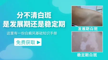 黑色素细胞移植手术效果怎么样