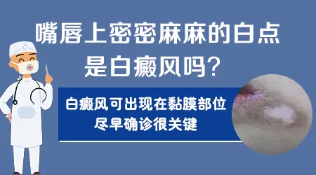 嘴唇上有白斑是什么原因