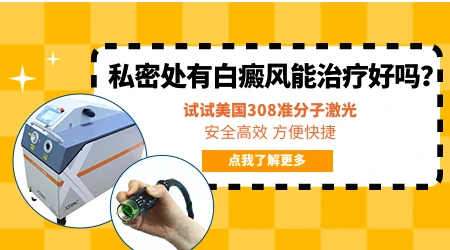 女生隐私部位白癜风怎么治