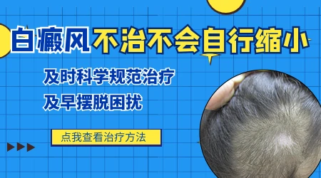 白癜风不治对人有哪些危害