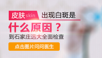 脸上白斑十几年了很光滑是什么