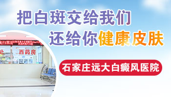 石家庄哪里治疗白斑[河北正规治皮肤白斑的医院]