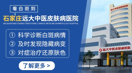 白癜风和白色糠疹的区别图