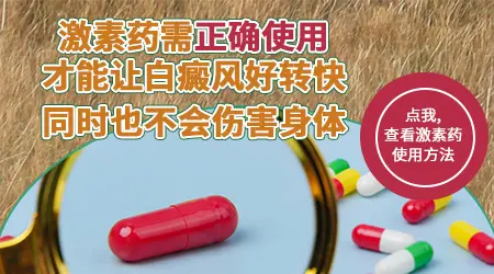 吃激素药能控制白癜风发展吗