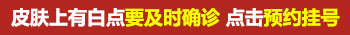 白斑和白癜风图片对比