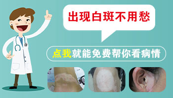 小孩胳膊上有小白点图片