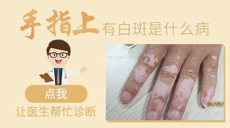 手指根部发白是得了什么皮肤病吗