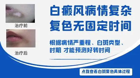 儿童眉毛里面绿豆大白斑多久能治好