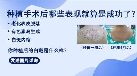 白斑做黑细胞种植后成功是什么样子的