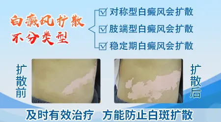 白斑初期症状图片