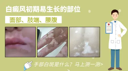 手上有硬币大小白斑点是什么