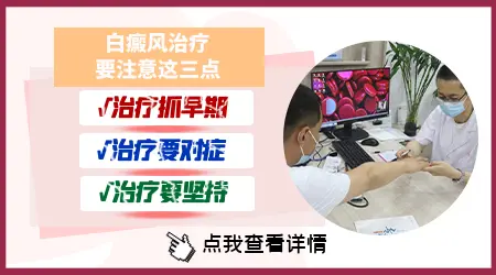 担心白斑是白癜风可以通过哪些方法判断