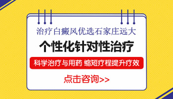 「石家庄白斑医院挂号」石家庄医院能否治好白癜风