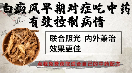 白癜风可以吃中药吗