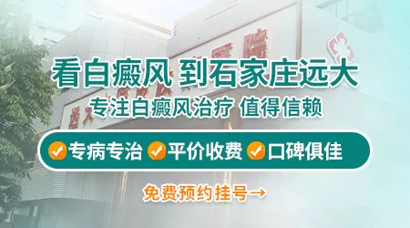 白斑像是白癜风做哪些检查