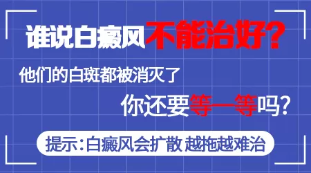 白癜风一般能活多久 白斑能根治吗