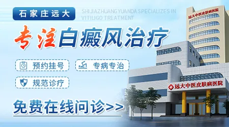 石家庄专治白癜风哪家医院好