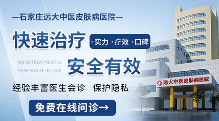 石家庄白癜风治疗医院哪家好