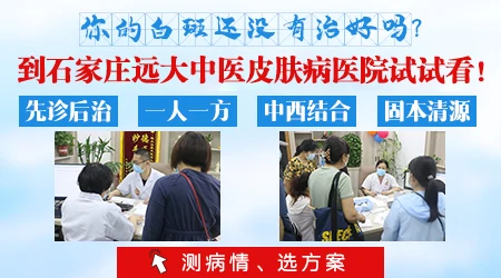 白癜风为什么治疗了很久还没好