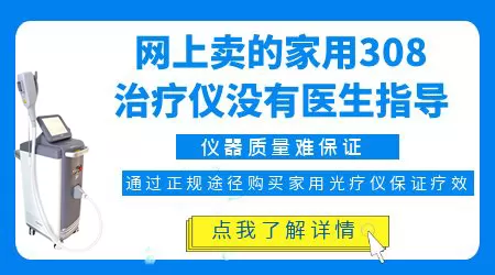 治疗白癜风家用光疗仪多少钱