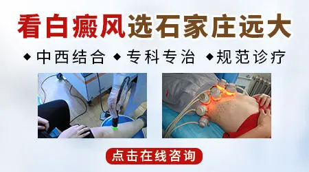 白癜风儿童图片