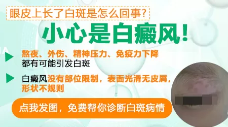 暴晒后眼眶周边皮肤有白斑