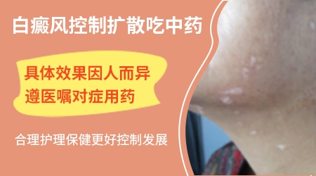 吃中药能不能控制住白癜风增长