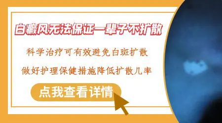 白癜风会不会只有一块不蔓延