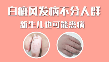 两个月的宝宝脖子有白点用什么方法治疗好