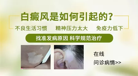 白斑是什么引起的