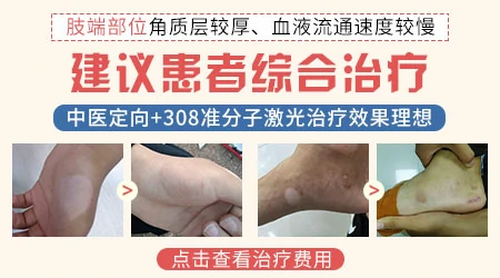 308治疗手指白癜风越照越白什么原因