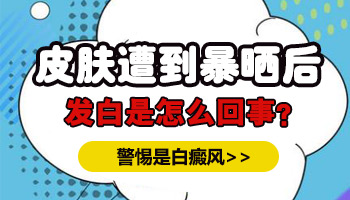 经常晒太阳身上突然白了一块