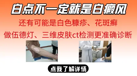 腿上长了几个小白点是怎么回事