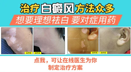 纳米促黑治疗白癜风是真的吗