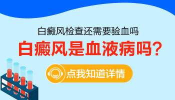 确诊白癜风要做哪些检查项目