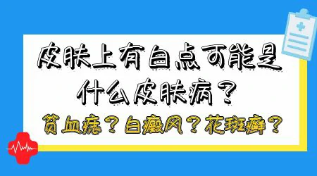 脸上长白斑是什么病