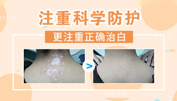 不明显的白斑照308后越来越白