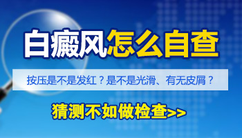 身上长白斑怎样自己检测是不是得了白癜风