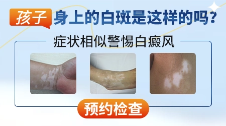 小孩腿上有白点是怎么回事