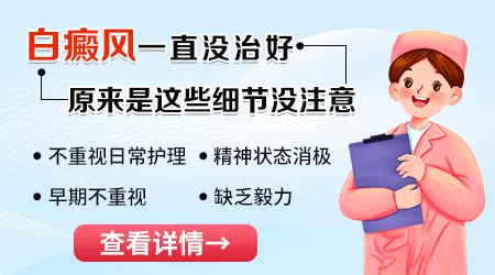 白癜风为什么治疗了很久还没好