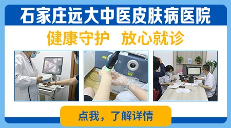 <a href=https://www.zhjianfa.com target=_blank class=infotextkey><a href=https://www.zhjianfa.com/ target=_blank class=infotextkey>石家庄<a href=https://www.zhjianfa.com/ target=_blank class=infotextkey>白癜风专科医院</a></a></a>哪家治疗效果好