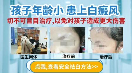 5岁小孩脸上有白色块怎么回事