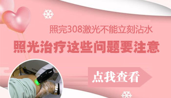 手指白癜风做完308激光能碰水吗