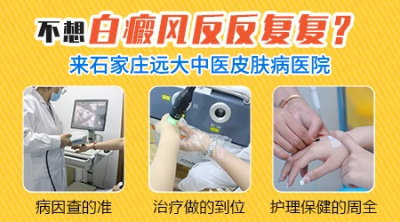 晕痣型白斑治疗大概多少钱